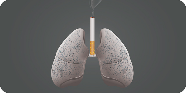 Smoking and COPD